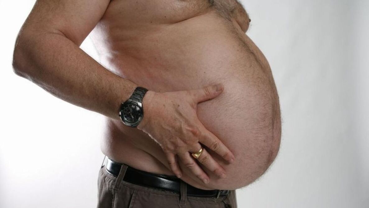 az elhízás, mint a visszér kialakulásának oka
