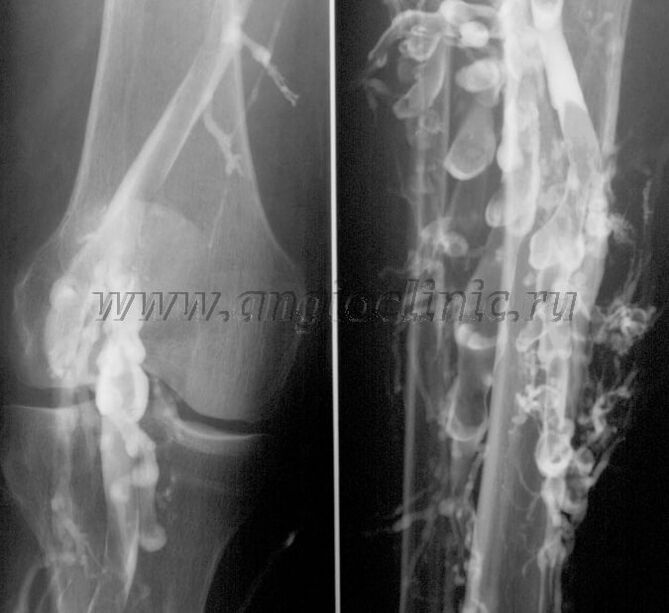 Ultrahang szkennelés